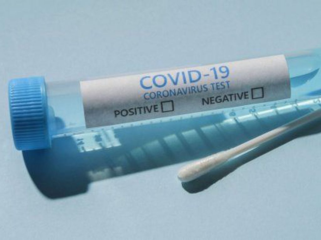 prix tests covid
